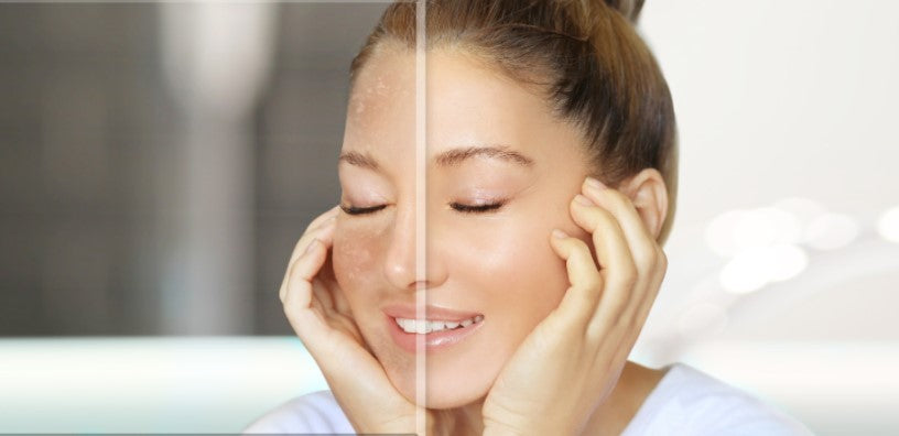 6 Tips to Prevent Dry Skin This Fall